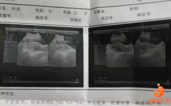<b>【广州供卵自怀 广州供卵论坛】坐等12周以后的全面检查，希望宝宝健康成长</b>